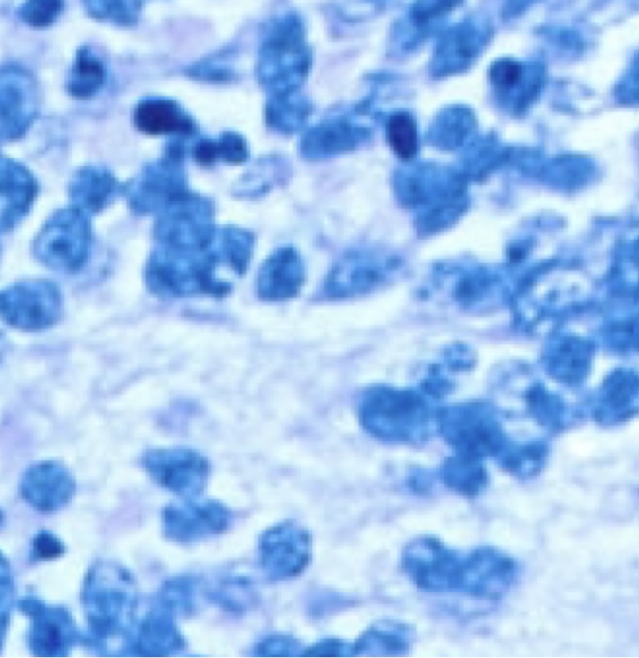 Analisi cellulare T98G